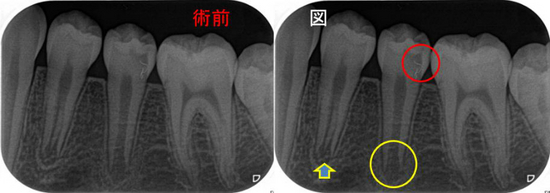 2020年10月アーカイブ - EE DENTAL_Blog